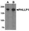 PH domain leucine-rich repeat protein phosphatase 1 antibody, orb75841, Biorbyt, Western Blot image 