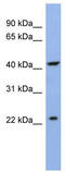 Solute Carrier Family 35 Member F1 antibody, TA345756, Origene, Western Blot image 