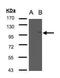 Protein FAN antibody, PA5-21512, Invitrogen Antibodies, Western Blot image 