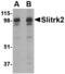 SLIT And NTRK Like Family Member 2 antibody, TA306523, Origene, Western Blot image 