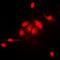 HemK methyltransferase family member 2 antibody, orb341253, Biorbyt, Immunocytochemistry image 