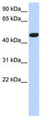 Calcium Voltage-Gated Channel Auxiliary Subunit Beta 4 antibody, TA341725, Origene, Western Blot image 