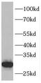 Inhibitor Of Growth Family Member 4 antibody, FNab04313, FineTest, Western Blot image 