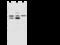 Proteasome 26S Subunit, Non-ATPase 5 antibody, 108177-T32, Sino Biological, Western Blot image 
