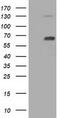 Pyruvate Kinase L/R antibody, M02282, Boster Biological Technology, Western Blot image 