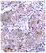 EGFR antibody, AP0153, ABclonal Technology, Immunohistochemistry paraffin image 