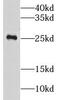 Lysophospholipase 1 antibody, FNab04905, FineTest, Western Blot image 