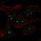 MYCN Proto-Oncogene, BHLH Transcription Factor antibody, NBP2-56178, Novus Biologicals, Immunocytochemistry image 