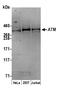 Serine-protein kinase ATM antibody, A300-136A, Bethyl Labs, Western Blot image 