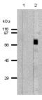 Perforin 1 antibody, M01429, Boster Biological Technology, Western Blot image 