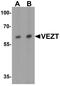 Vezatin, Adherens Junctions Transmembrane Protein antibody, A09587, Boster Biological Technology, Western Blot image 
