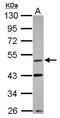VRK Serine/Threonine Kinase 1 antibody, GTX107899, GeneTex, Western Blot image 