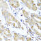 Aspartyl-tRNA synthetase, mitochondrial antibody, 23-202, ProSci, Immunohistochemistry paraffin image 