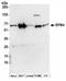 TBC1 Domain Family Member 10A antibody, NBP2-36551, Novus Biologicals, Western Blot image 