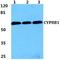 Cytochrome P450 Family 8 Subfamily B Member 1 antibody, A05518-2, Boster Biological Technology, Western Blot image 