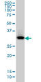 Quinolinate Phosphoribosyltransferase antibody, LS-C133705, Lifespan Biosciences, Western Blot image 
