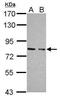 cGMP-dependent protein kinase 1 antibody, GTX111610, GeneTex, Western Blot image 
