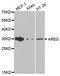 Amphiregulin antibody, LS-C331735, Lifespan Biosciences, Western Blot image 