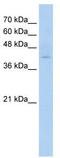 Transmembrane Protein 8B antibody, TA346269, Origene, Western Blot image 