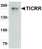 RAC-gamma serine/threonine-protein kinase antibody, orb344546, Biorbyt, Western Blot image 