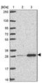 Ribosomal Protein L10a antibody, NBP2-47298, Novus Biologicals, Western Blot image 