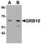 Growth Factor Receptor Bound Protein 10 antibody, A01663, Boster Biological Technology, Western Blot image 