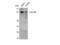 X-Ray Repair Cross Complementing 5 antibody, STJ93866, St John