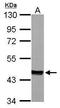 Mevalonate Diphosphate Decarboxylase antibody, TA307889, Origene, Western Blot image 