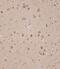STE20 Related Adaptor Alpha antibody, A01112-2, Boster Biological Technology, Immunohistochemistry paraffin image 