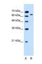 Solute Carrier Family 22 Member 3 antibody, NBP1-69368, Novus Biologicals, Western Blot image 