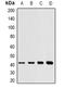 Ectonucleotide pyrophosphatase/phosphodiesterase family member 2 antibody, orb378047, Biorbyt, Western Blot image 