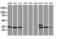 Protein Tyrosine Phosphatase Non-Receptor Type 7 antibody, LS-C173393, Lifespan Biosciences, Western Blot image 