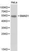 SMAD Family Member 1 antibody, LS-C192445, Lifespan Biosciences, Western Blot image 