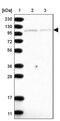 Diacylglycerol Kinase Theta antibody, PA5-55422, Invitrogen Antibodies, Western Blot image 
