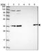 Arylsulfatase Family Member K antibody, NBP1-84209, Novus Biologicals, Western Blot image 