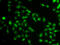 L3MBTL Histone Methyl-Lysine Binding Protein 1 antibody, abx005360, Abbexa, Western Blot image 