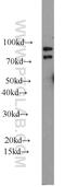 85 kDa calcium-independent phospholipase A2 antibody, 22030-1-AP, Proteintech Group, Western Blot image 