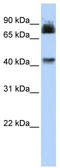 Purinergic Receptor P2X 2 antibody, TA338742, Origene, Western Blot image 