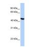 Putative male-specific lethal-3 protein-like 2 antibody, NBP1-91412, Novus Biologicals, Western Blot image 