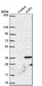 X-C Motif Chemokine Receptor 1 antibody, HPA013169, Atlas Antibodies, Western Blot image 