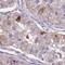 Ferrochelatase, mitochondrial antibody, HPA044100, Atlas Antibodies, Immunohistochemistry frozen image 