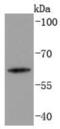 Keratin 2 antibody, NBP2-67838, Novus Biologicals, Western Blot image 