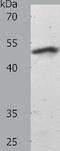 SMAD Family Member 7 antibody, TA322546, Origene, Western Blot image 