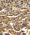 ATP Binding Cassette Subfamily G Member 1 antibody, LS-C155863, Lifespan Biosciences, Immunohistochemistry paraffin image 