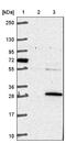COMM Domain Containing 3 antibody, NBP1-88519, Novus Biologicals, Western Blot image 