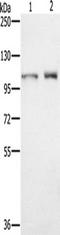 Outer Dense Fiber Of Sperm Tails 2 antibody, TA350250, Origene, Western Blot image 