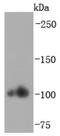 Actinin Alpha 2 antibody, NBP2-67143, Novus Biologicals, Western Blot image 