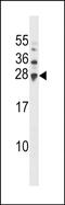 Ubiquitin Conjugating Enzyme E2 H antibody, PA5-48806, Invitrogen Antibodies, Western Blot image 
