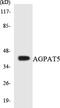 1-Acylglycerol-3-Phosphate O-Acyltransferase 5 antibody, LS-C200103, Lifespan Biosciences, Western Blot image 