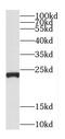 Chromosome 5 Open Reading Frame 24 antibody, FNab01119, FineTest, Western Blot image 